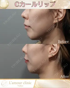 null days after image