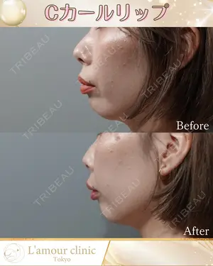 null days after image