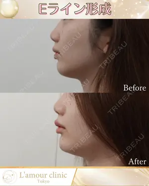 null days after image