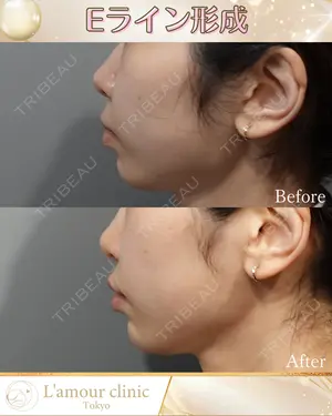 null days after image