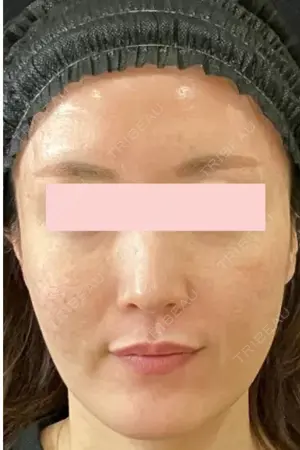 null days after image