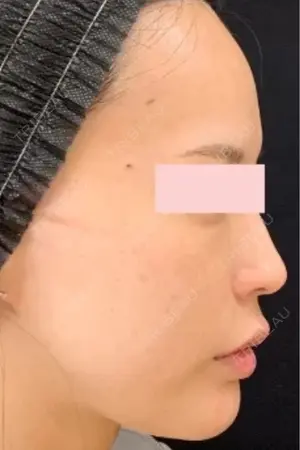 null days after image