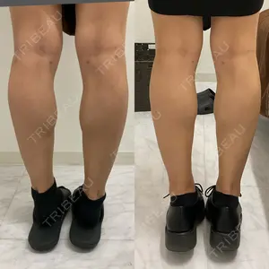 null days after image