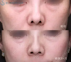 90 days after image