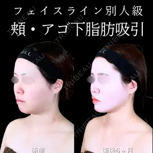 180 days after image