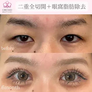 180 days after image