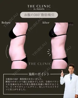 null days after image