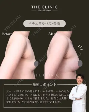 null days after image