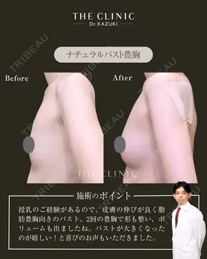 null days after image