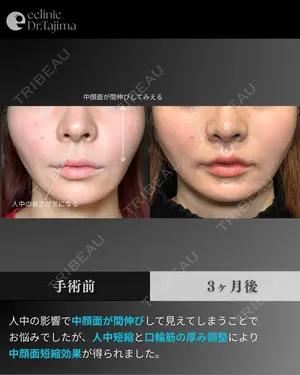 90 days after image