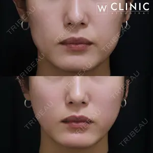 null days after image