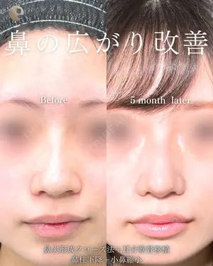 null days after image