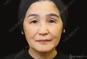 365 days after image