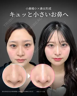 120 days after image