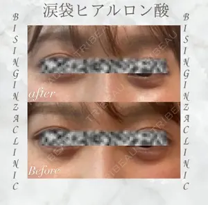 null days after image