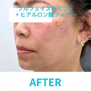 null days after image