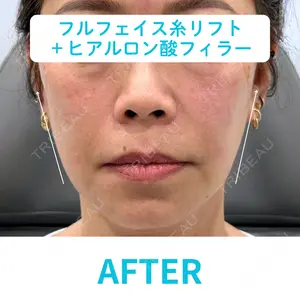 null days after image