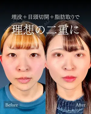 null days after image