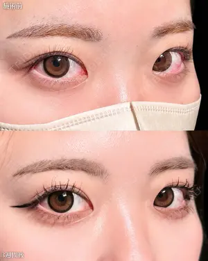 null days after image