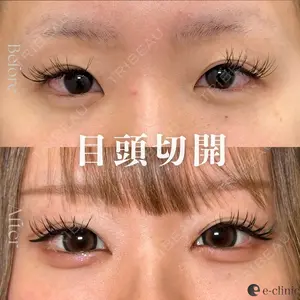 before image
