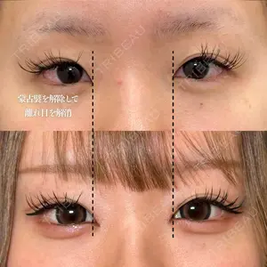 90 days after image
