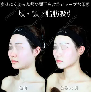 180 days after image