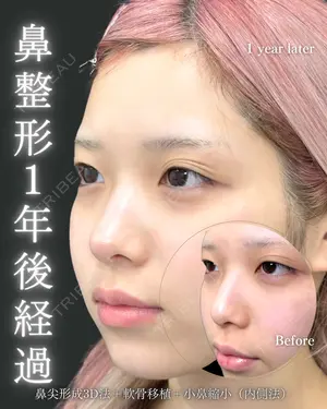 null days after image