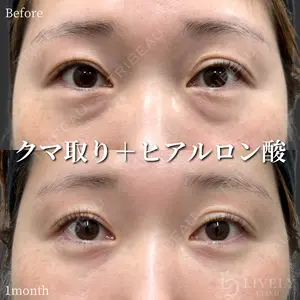 null days after image