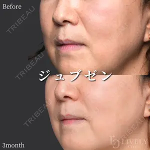 null days after image