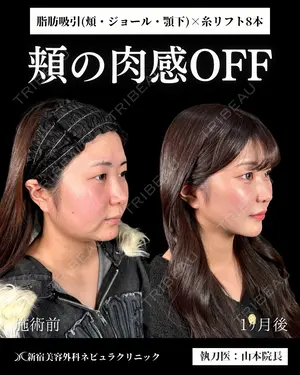 null days after image