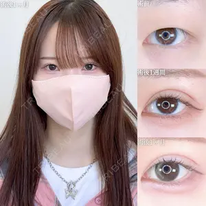 null days after image