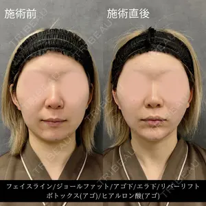 before image
