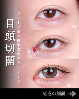30 days after image