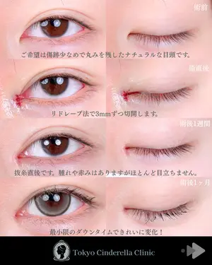 before image