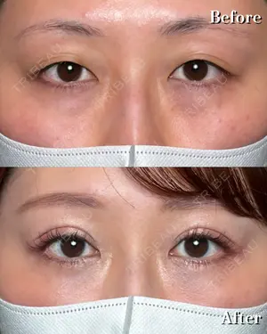 30 days after image