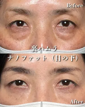 30 days after image