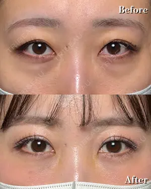 7 days after image
