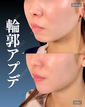 before image