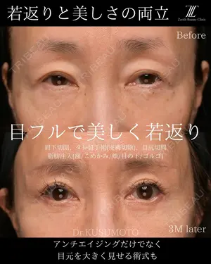 90 days after image