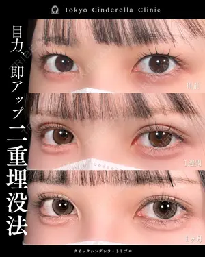 30 days after image
