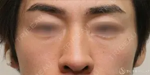 365 days after image