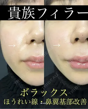 null days after image