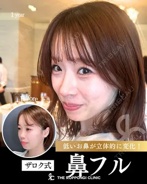 365 days after image