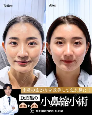 180 days after image