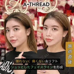 null days after image