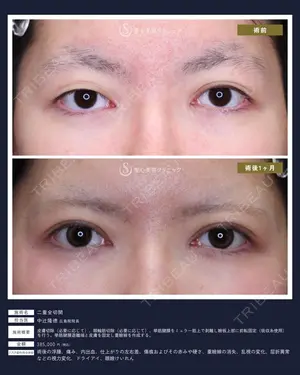 30 days after image