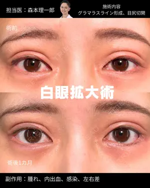 null days after image