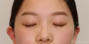 30 days after image
