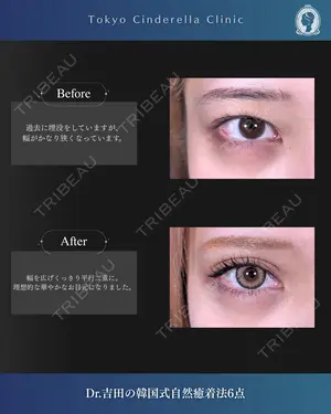 before image