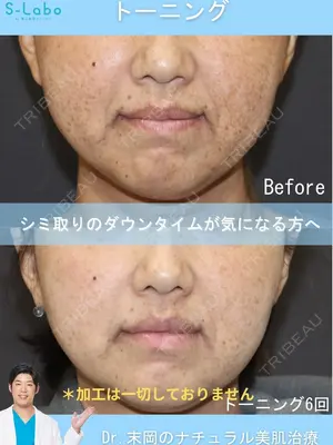 before image